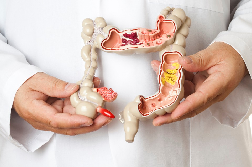 Cirurgia de Câncer Colorretal e Seus Efeitos Colaterais/Sequelas