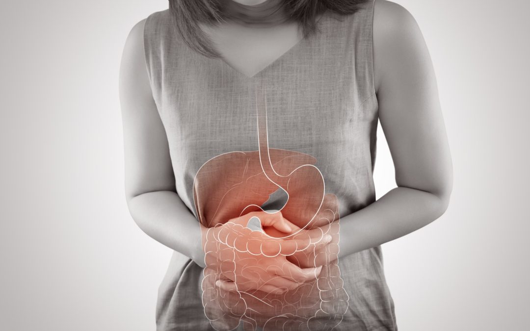 Doenças Inflamatórias Intestinais e O Câncer De Intestino