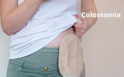 Colostomia