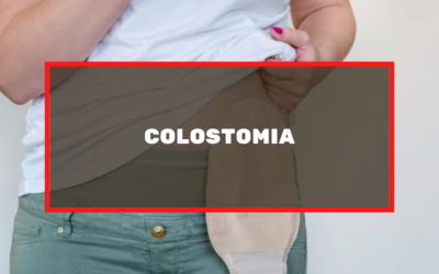 Colostomia