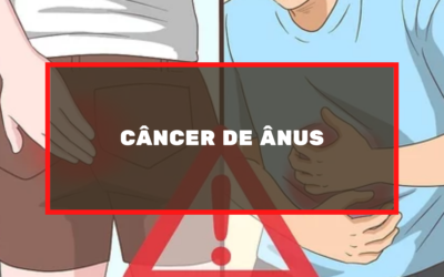 Câncer de Ânus