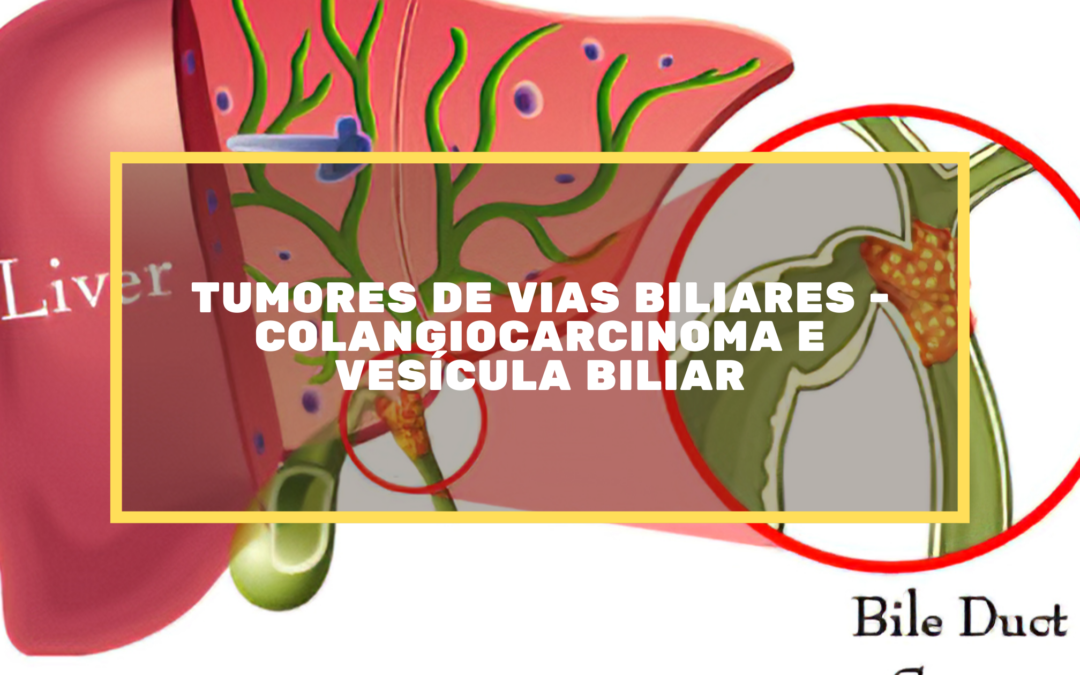 Tumores De Vias Biliares – Colangiocarcinoma E Vesícula Biliar